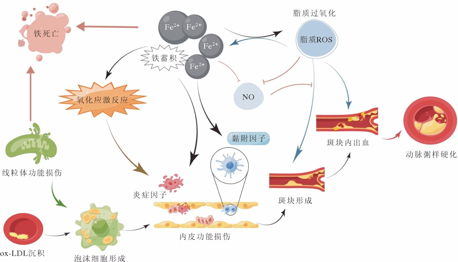 铁死亡在动脉粥样硬化中的作用及其靶向治疗研究进展